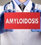עמילואידוזיס:  המחלה שקשה לאבחן-תמונה