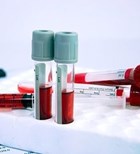 סוג דם - blood group-תמונה