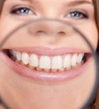 יישור שיניים בשיטת ארודנטיס (אילוסטרציה)