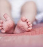 עיוותי רגליים אצל תינוקות וילדים (אילוסטרציה shutterstock)