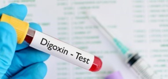 בדיקת דיגוקסין (Digoxin Test) - תמונה