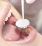 טיפולי שיניים לחולים בסיכון גבוה-תמונה