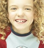 שיני חלב: חשוב לעקוב מגיל צעיר-תמונה