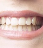 יישור שיניים: לעזור לגנטיקה (צילום: אילוסטרציה)