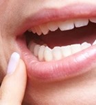 שיניים, חניכיים או שפתיים: איזו בעיה אסתטית מפריעה לכם בפה? -תמונה