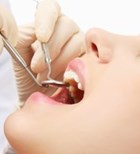 רשלנות רפואית ברפואת שיניים (אילוסטרציה)