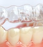 חריקת שיניים: זיהוי וטיפול-תמונה