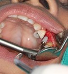 טיפולי שיניים בסיסים לחסרי מעמד בת'א (אילוסטרציה shutterstock)