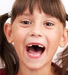 מרווח בין השיניים - תמונת המחשה מרווח בין השיניים - תמונת המחשה