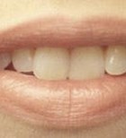 נותנים אגוזים למי שיש שיניים-תמונה נותנים אגוזים למי שיש שיניים-תמונה