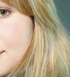 דליפת שתן: לא להתבייש-תמונה דליפת שתן: לא להתבייש-תמונה