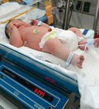 התינוק בפגייה ברמב'ם. צילום: עופר גולן   התינוק בפגייה ברמב'ם. צילום: עופר גולן
