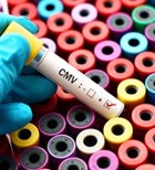 נגיף CMV בהריון: מחלת הנשיקה נגיף CMV בהריון: מחלת הנשיקה