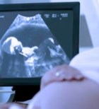 הרחבת אגן כליה: מה לעשות?-תמונה הרחבת אגן כליה: מה לעשות?-תמונה