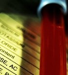 מניעת הדבקה לאחר חשיפה ל-HIV-תמונה מניעת הדבקה לאחר חשיפה ל-HIV-תמונה