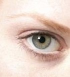 עלייה בעובי הקרנית - תמונת אווירה עלייה בעובי הקרנית - תמונת אווירה