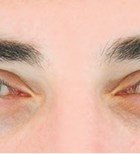 מולטי ויטמינים בריאים לראייה-תמונה מולטי ויטמינים בריאים לראייה-תמונה