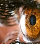 קרנית העין: מחלות - וטיפולים-תמונה