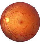 הפרעות ראייה ממקור עצבי-תמונה הפרעות ראייה ממקור עצבי-תמונה