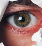 שבר בארובת העין: אבחון וטיפול-תמונה