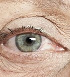 ניוון רשתית - תמונת אווירה ניוון רשתית - תמונת אווירה