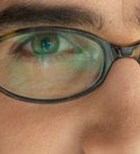 שאלות נפוצות מפורום ניתוחים להסרת משקפיים-תמונה