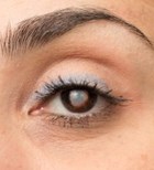 ניתוח קטרקט: לכל שאלה - תשובה-תמונה ניתוח קטרקט: לכל שאלה - תשובה-תמונה