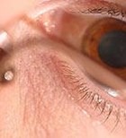 אפי לייזר, אינטראלייזר ומה שביניהם-תמונה אפי לייזר, אינטראלייזר ומה שביניהם-תמונה