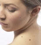 סרטן העור: סקירה מחקרית