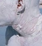 מלנומות - גילוי סקירה ומעקב-תמונה מלנומות - גילוי סקירה ומעקב-תמונה