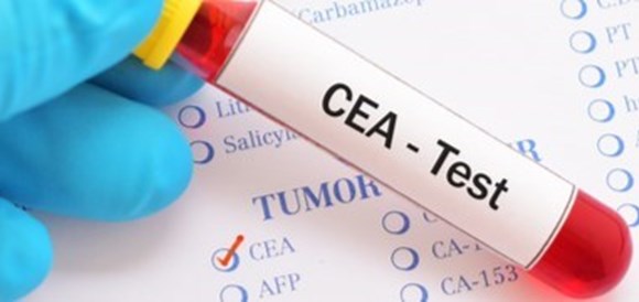 בדיקת CEA - תמונה