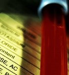 בדיקת דם תגלה סרטן המעי הגס-תמונה בדיקת דם תגלה סרטן המעי הגס-תמונה