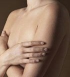 ירידה של 30% בתמותה מסרטן השד-תמונה ירידה של 30% בתמותה מסרטן השד-תמונה