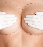 ניתוח פלסטי בשדיים? כדאי להציץ-תמונה ניתוח פלסטי בשדיים? כדאי להציץ-תמונה