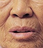 עור לגויים-תמונה עור לגויים-תמונה