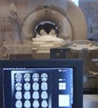 סוכרתיים ופגיעה מוחית-תמונה סוכרתיים ופגיעה מוחית-תמונה