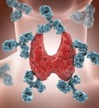 השימוטו: מתקפה על בלוטת התריס-תמונה השימוטו: מתקפה על בלוטת התריס-תמונה