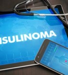 גידול אינסולינומה: סיכוי גבוה לריפוי-תמונה