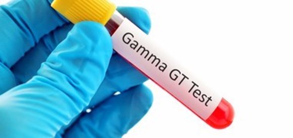בדיקת רמות GGT - Gamma-Glutamyl Transferase - תמונה
