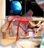 צינתור לב וירטואלי באמצעות CT-תמונה צינתור לב וירטואלי באמצעות CT-תמונה