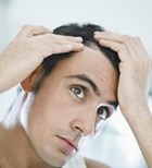 התקרחות  התקרחות