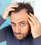 התקרחות - שיטות לטיפול (אילוסטרציה) התקרחות - שיטות לטיפול (אילוסטרציה)