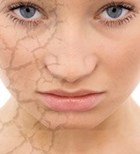 מחלות עור: לראות את האור-תמונה מחלות עור: לראות את האור-תמונה