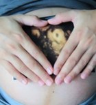 סקירת מערכות בהריון: כל הסיבות-תמונה