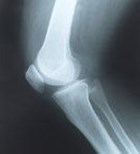 מחר נקנה מפרק חדש מחר נקנה מפרק חדש