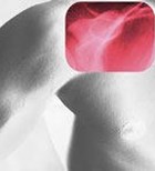 חולי מפרקים בישראל: תמונת מצב 2006 חולי מפרקים בישראל: תמונת מצב 2006