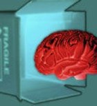 שבץ מוחי: קווים לדמותו-תמונה שבץ מוחי: קווים לדמותו-תמונה