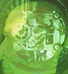 שבץ מוחי: הכל צפוי והרשות נתונה? שבץ מוחי: הכל צפוי והרשות נתונה?