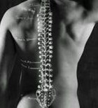 עקמת עמוד השדרה  Scoliosis עקמת עמוד השדרה  Scoliosis
