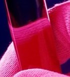 תלסמיה-תמונה תלסמיה-תמונה